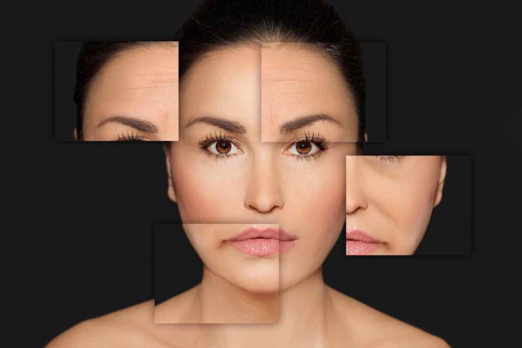 plasmagique facelift nosurgical san francisco